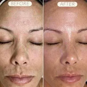 Real Client Transformations