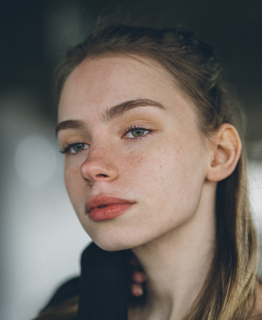 Are You a Suitable Candidate for Filler Dissolving?