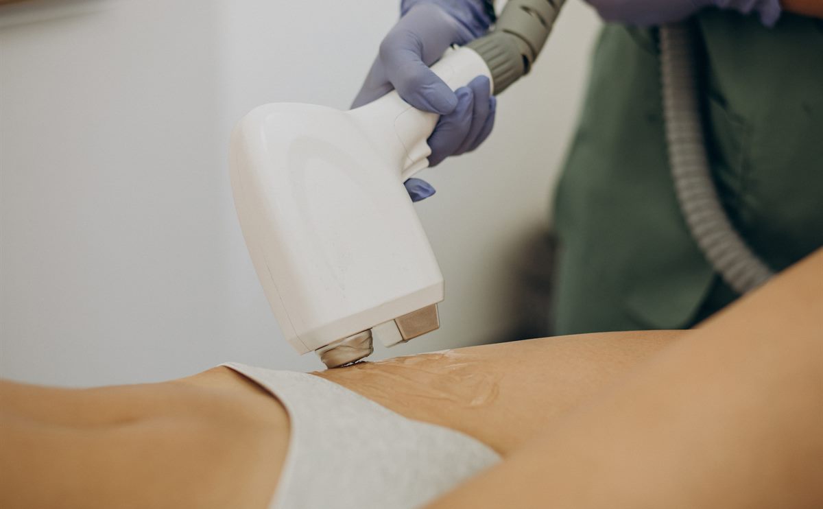 How Laser Hair Removal Works for Women