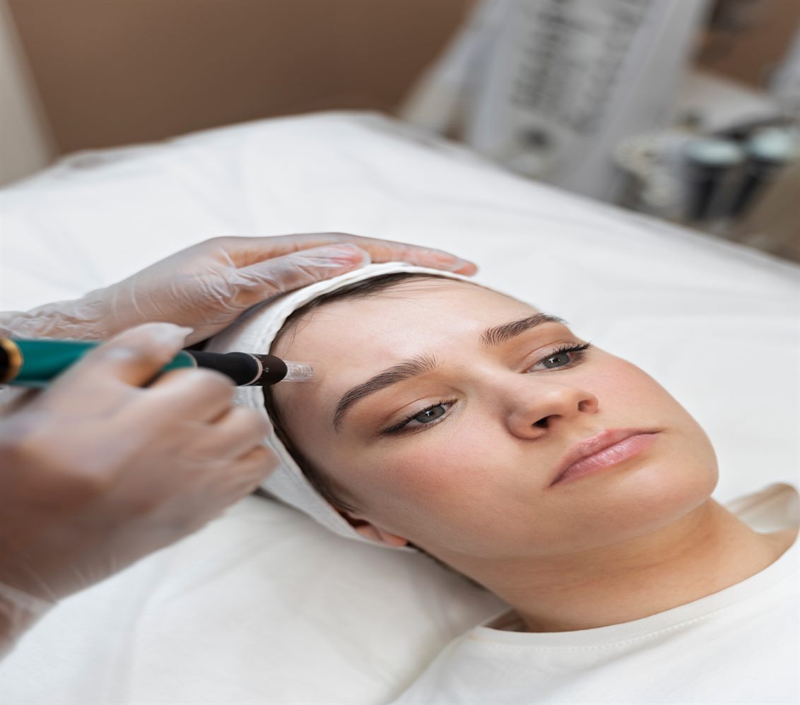 Microdermabrasion Skin Resurfacing