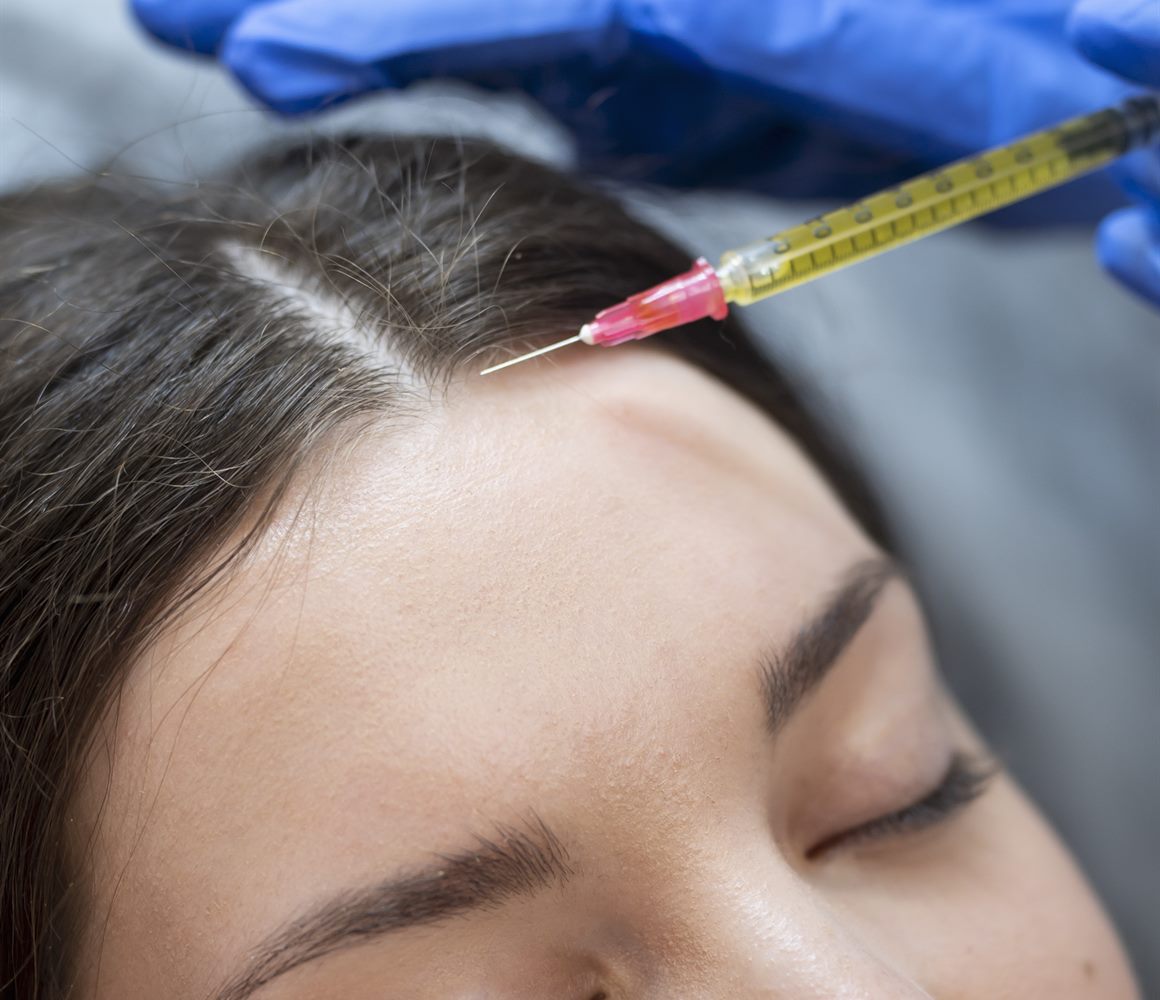 Platelet-Rich Plasma (PRP) Treatments